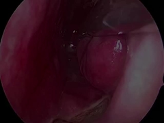 Máy thăm dò thần kinh cực nhỏ và linh hoạt PLA407