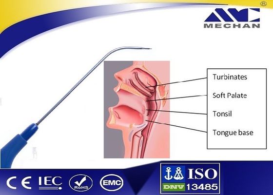 Đầu dò tai mũi họng cơ học Plasma để phân luồng và cắt bỏ ống
